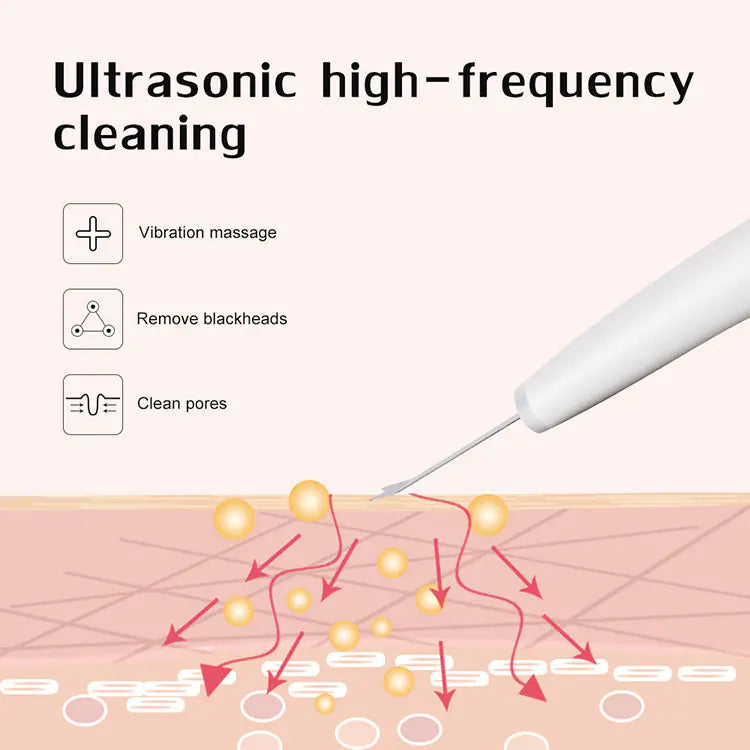 Hailicar Ultrasonic Exfoliating Skin Scraper Device